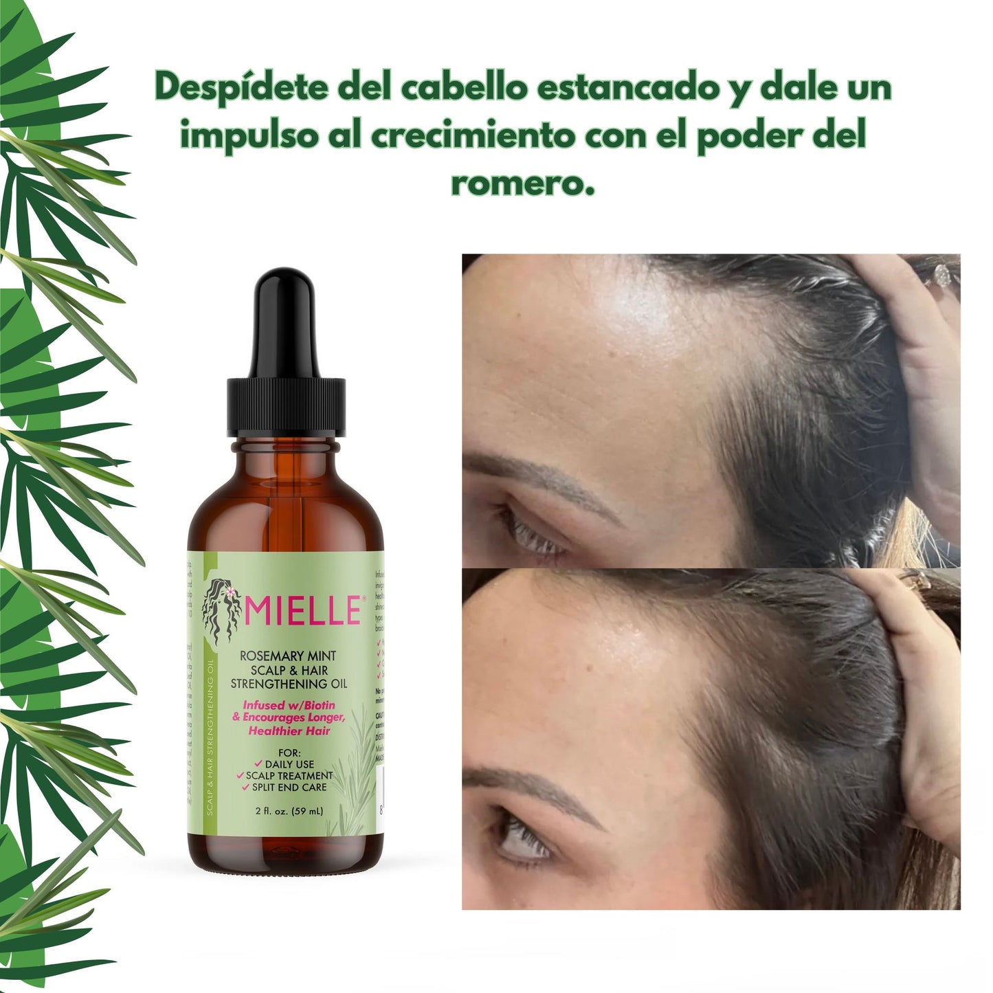 ACEITE POTENCIALIZADOR DE CRECIMIENTO CON ROMERO Y MENTA PARA EL CABELLO