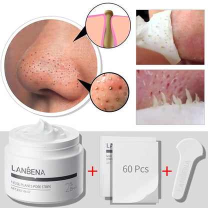 LANBENA 2.0 GlowStrip™– Removedor de puntos negros instantáneo