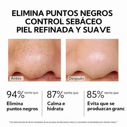 LANBENA 2.0 GlowStrip™– Removedor de puntos negros instantáneo